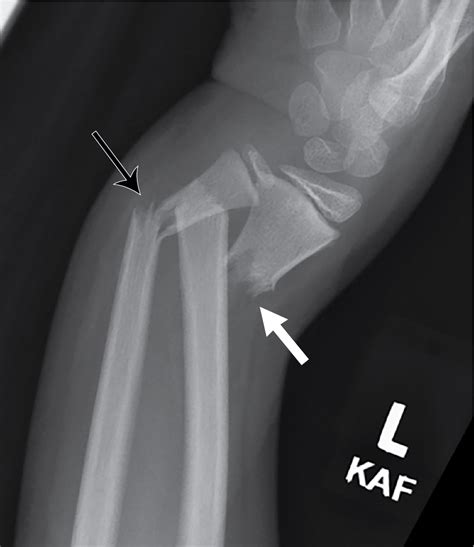 Lets Play Forearm Fractures Radiology Key