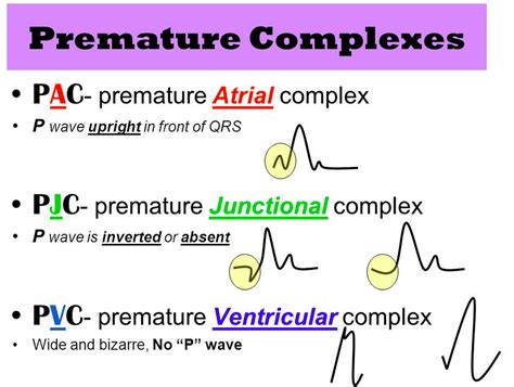 Pac Pjc And Pvc Paramedic Cheat Sheets Pinterest Cardiology