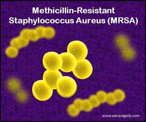 Methicillin Resistant Staphylococcus Aureus Mrsa We Care