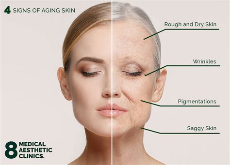 4 Signs Of Aging Skin And How To Treat Them Effectively 8 Medical