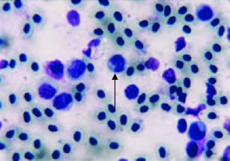 Lung Smear From Mycoplasma Infected Cases Consisting Mainly Macrophage