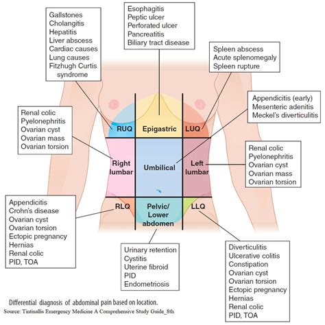 Abdominal Pain Differential Diagnosis Chart Google Search Nurse My