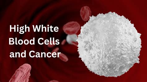 High White Blood Cells And Cancer