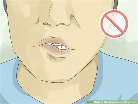 3 Simple Ways To Heal Lips After Biting Them 👄