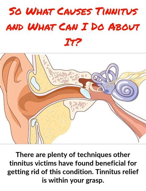 Pin On Tinnitus Causes