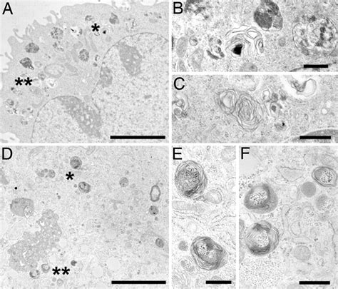 A Pure Population Of Lung Alveolar Epithelial Type Ii Cells Derived