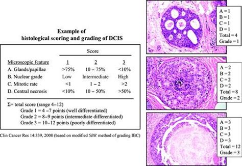 Ductal Carcinoma In Situ Terminology Classification And Natural History