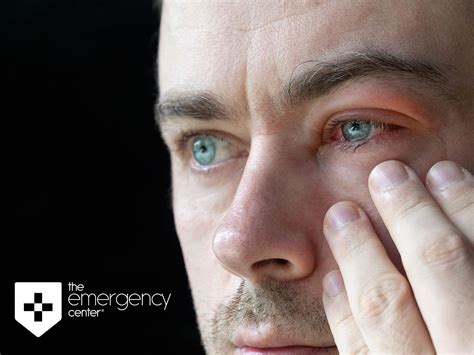 Pink Eye Conjunctivitis Symptoms Causes And Treatment