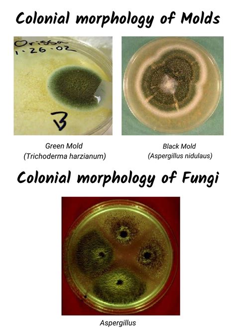 Colony Morphology Of Bacteria And Examples