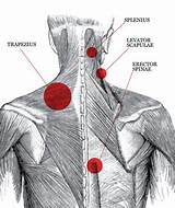 Which Doctor To See For Neck And Shoulder Pain