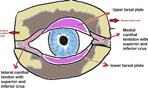 Ocular Compartment Syndrome And Lateral Canthotomy Procedure Journal