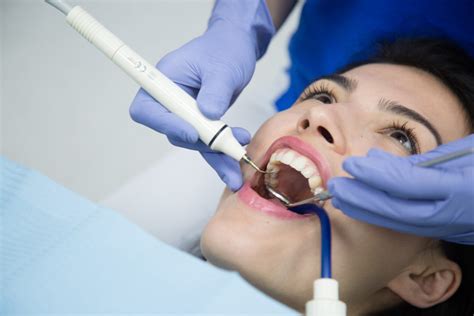 Dental Prophylaxis Dr Butaș Dental Clinique