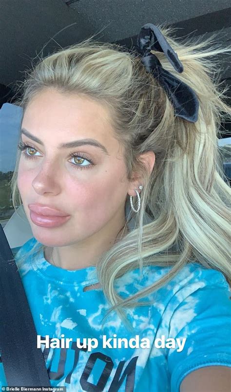 Brielle Biermann Reveals That She Couldn T Be Happier After Having Her Dissolved Lips Re