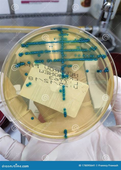 Enterococcus Faecalis Cultivo De Orina En Agar Cromogénico Stock De