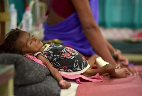 India Home To Largest Number Of Stunted Children In World Report