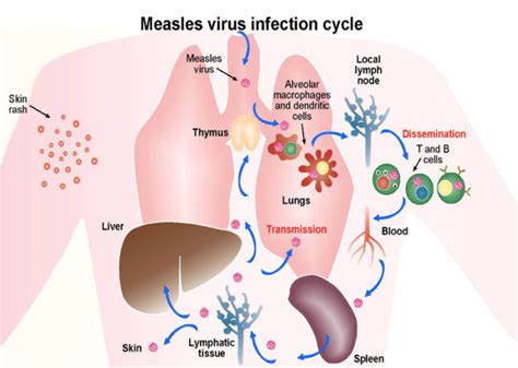 Measles And Immune Amnesia