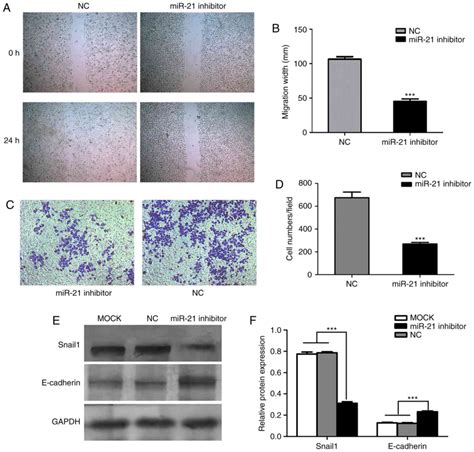 role of mir 21 in the growth and metastasis of human salivary adenoid cystic carcinoma