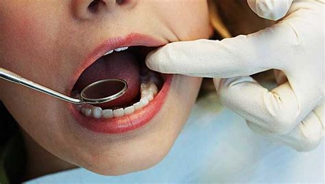 Harga atau biaya cukup beragam, di klinik bisa mencapai 2 jutaan sedangkan di puskesmas tentu akan lebih terjangkau lagi. Mahu rawatan murah, cepat dorong kewujudan doktor gigi ...