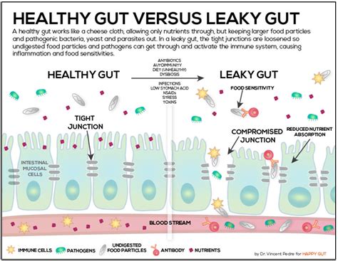 Leaky Gut Inflammation Autoimmune Diseases Food And Your Addictive Mind