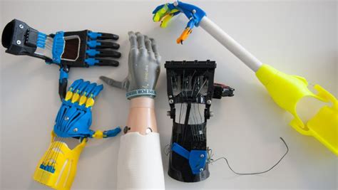 Why 3 D Prosthetics Are The Future Opinion Cnn