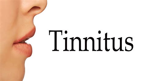 How To Say Tinnitus Youtube