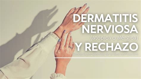 Dermatitis Nerviosa Atópica O Alérgica Y Rechazo Desde La Perspectiva De La Descodificación