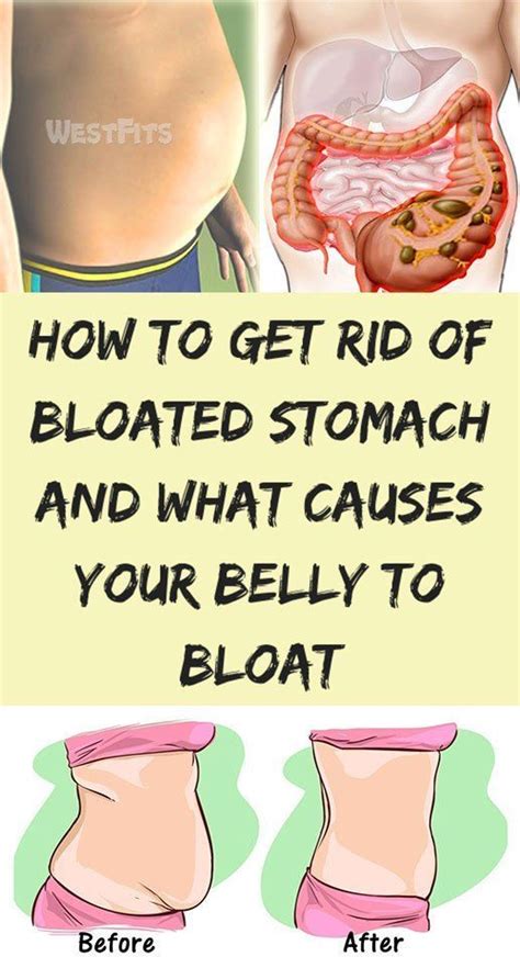 How To Get Rid Of Bloated Stomach And What Causes Your Belly To Bloat Get Rid Of Bloated