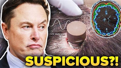 The Shocking Reason Why Elon Musks Neuralink Is Under Investigation Youtube