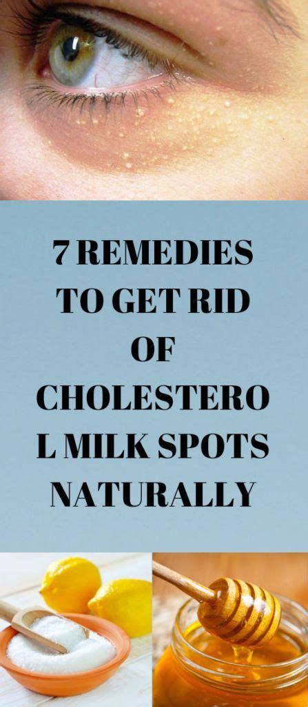 7 Remedies To Get Rid Of Cholesterol Milk Spots Naturally In 2020