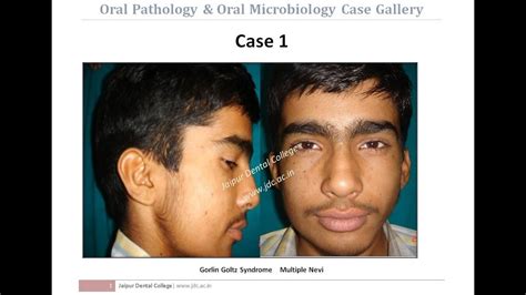 Case Gallery Of Oral Pathology And Oral Microbiology Youtube