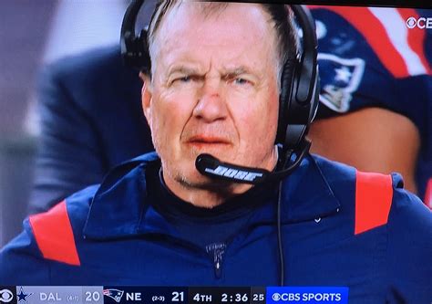bill belichick shown with cuts on his face nose and lips
