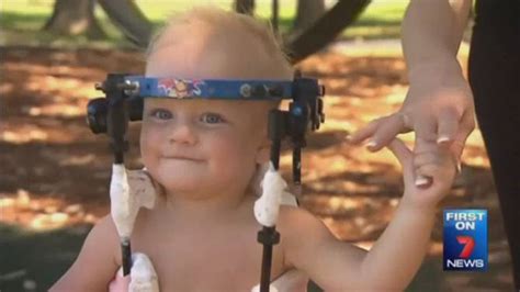 Australian Babys Head Reattached To Severed Spinal Cord In ‘miracle