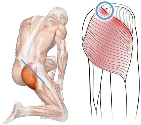 Extension of the hip, assists. Massage for Upper Gluteal Pain (Gluteus Maximus)
