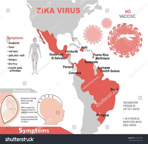 zika virus infographic elements prevention transmission stock vector royalty free 373318705