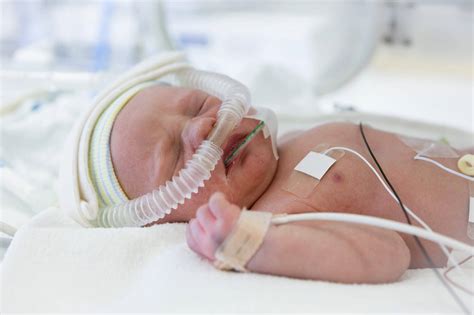 Nippv And High Level Pulmonary Support In Neonates Rt