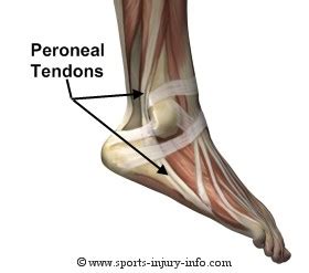 Ligaments keep your bones connected to one another and help keep your skeleton connected and stable. Peroneal Tendonitis? | Running Joe