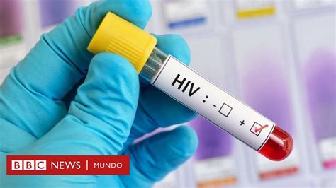 Fourteen people were functionally cured of hiv through rapid treatment after early diagnosis, giving hope to those infected. Cabotegravir, el nuevo tratamiento inyectable "altamente ...