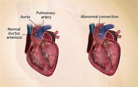 Health Condition Symptoms Causes Treatment And More