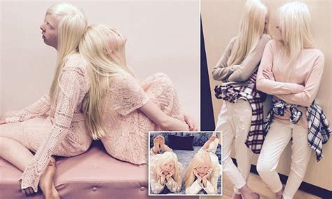 Best Friends With Albinism Launch Fashion Instagram Daily Mail Online