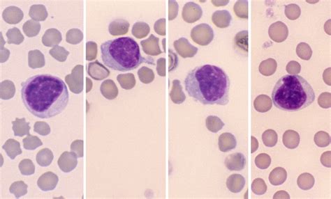 Mature Lymphocytes Cells And Smears