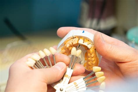 Learn How Reliable Dental Implants Abroad Are