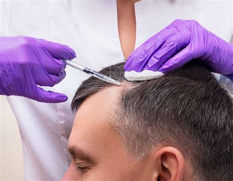 پی آر پی مو چیست و چگونه به رشد مو کمک می کند دکتر نابت تاجمیر ریاحی