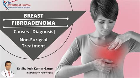 Treating Breast Fibroadenoma Without Surgery In Hyderabad