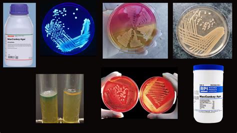 Types Of Culture Media In Microbiology Rbr Life Science