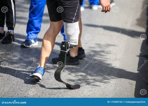 Details With A Prosthetic Leg On An Army Veteran During A Running Race