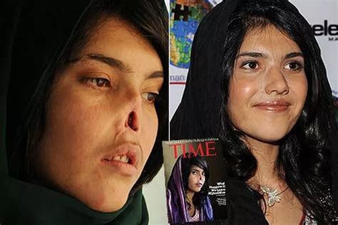 Bibi Aisha Bravely Shows Her New Face After Taliban Cut Off Her Nose And Ears Mirror Online