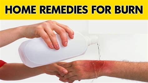 Burn How To Treat A First Degree Burn Home Remedies For Burns