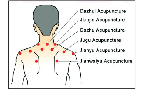 Acupuncture Points For Neck Shoulder Pain Acupuncture Acupressure Points