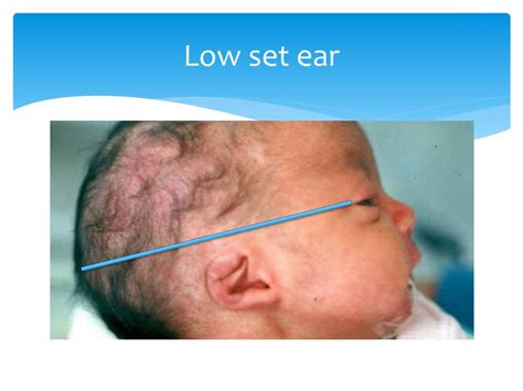 Ppt Normal Newborn Care Powerpoint Presentation Free Download Id