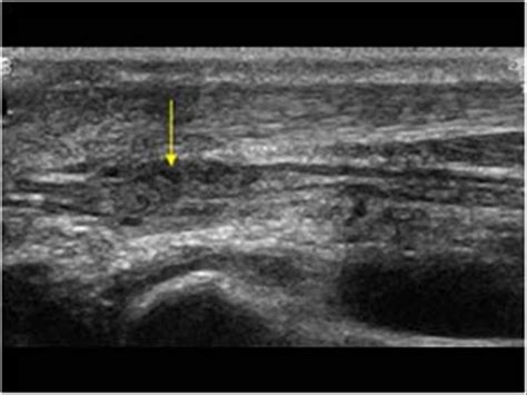 Musculoskeletal Bone Muscle Nerves And Other Soft Tissues 73